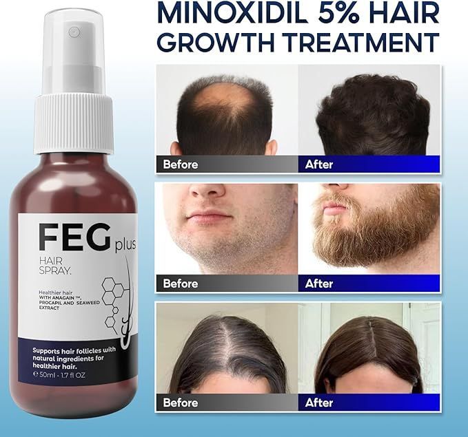 FEG Hair Growth Spray PLUS/ Formulated with 5% Minoxidil, our hair growth spray serum is designed to help stimulate hair follicles for faster, thicker hair growth.